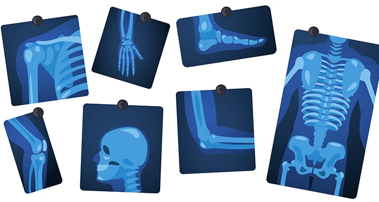 Radiology-banner-750x400-1